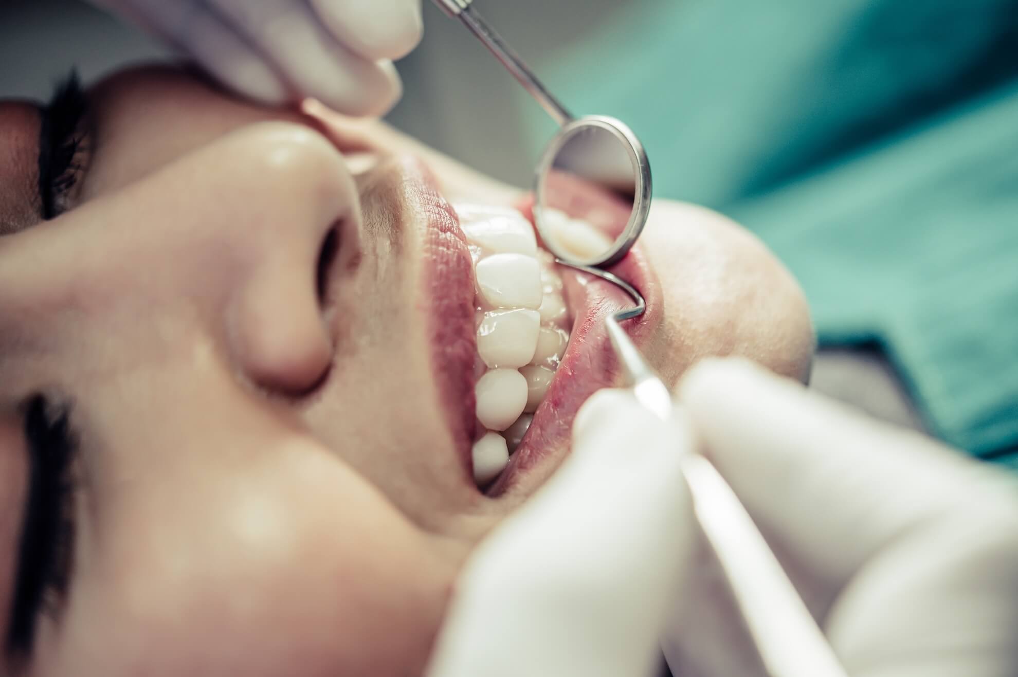 dentista o barco valdeorras Primer plano de una persona que recibe un examen dental. Un dentista con guantes utiliza herramientas dentales, entre ellas un espejo y un explorador, para examinar los dientes de la persona. La persona sonríe y muestra sus dientes limpios.